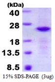 Human CRYGN protein, His tag. GTX57369-pro