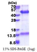 Human FAM84B protein, His tag. GTX57370-pro