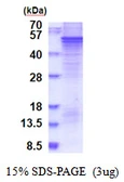 Human Spred1 protein, His tag. GTX57371-pro