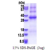Human ADAL protein, His tag. GTX57372-pro