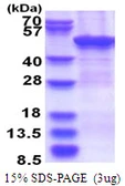 Human ZCCHC12 protein, His tag. GTX57375-pro