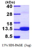 Human S100Z protein, His tag. GTX57376-pro