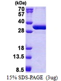 Human NSMCE1 protein, His tag. GTX57382-pro