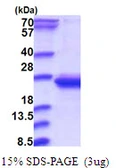 Human RWDD4 protein, His tag. GTX57384-pro