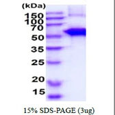 Mouse SLA/LP protein, His tag. GTX57386-pro