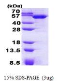 Human TBCEL protein, His tag. GTX57387-pro