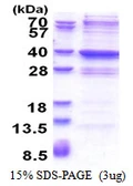 Human GLYATL2 protein, His tag. GTX57388-pro