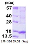 Human ORAV1 protein, His tag. GTX57389-pro