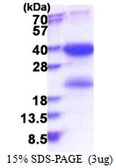 Human SKA1 protein, His tag. GTX57390-pro