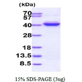 Human ALKBH3 protein, His tag. GTX57392-pro