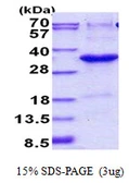 Human JAZF1 protein, His tag. GTX57394-pro