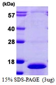 Human CDC26 protein, His tag. GTX57396-pro