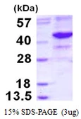 Human NEIL2 protein, His tag. GTX57398-pro