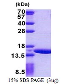 Human GTLF3B protein, His tag. GTX57400-pro