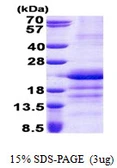 Human GATC protein, His tag. GTX57408-pro