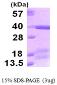 Human TICAM2 protein, His tag. GTX57415-pro