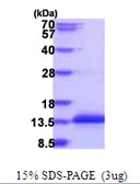 Human CCDC23 protein, His tag. GTX57419-pro