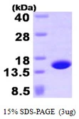 Human Profilin 4 protein, His tag. GTX57420-pro