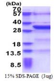 Human KCTD4 protein, His tag. GTX57422-pro