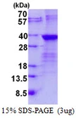 Human LIN28B protein, His tag. GTX57427-pro
