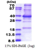 Human CENPP protein, His tag. GTX57430-pro