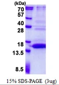 Human UFSP1 protein, His tag. GTX57431-pro