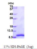 Human GTF2H5 protein, His tag. GTX57434-pro