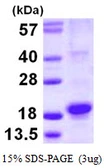 Human RGS21 protein, His tag. GTX57436-pro