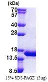 Human INCA protein, His tag. GTX57437-pro