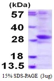 Human Phosphatase orphan 2 protein, His tag. GTX57440-pro