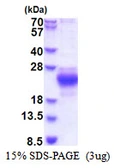 Human CHAC2 protein, His tag. GTX57441-pro