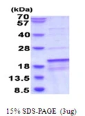 Human SDHAF1 protein, His tag. GTX57444-pro