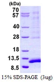 Human SYCE3 protein, His tag. GTX57445-pro