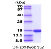 Human T-FABP protein, His tag. GTX57447-pro