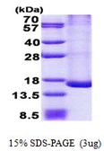 Human TRAPPC2L protein, His tag. GTX57453-pro