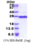 Human GAGE2D protein, His tag. GTX57455-pro