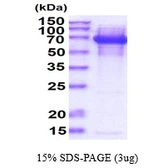 E. coli DnaK protein. GTX57460-pro