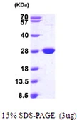 E. coli NFNB protein, His tag. GTX57466-pro