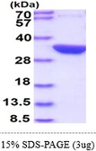 E. coli glsA1 protein, His tag. GTX57470-pro