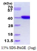 E. coli IdhA protein, His tag. GTX57472-pro