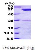 E. coli phrB protein, His tag. GTX57479-pro