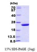 E. coli mug protein, His tag. GTX57486-pro