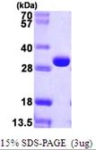 E. coli deoC protein, His tag. GTX57500-pro