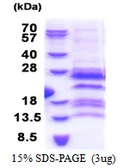 Human GAGE12F protein, His tag. GTX57501-pro