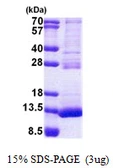 Human TSTD3 protein, His tag. GTX57503-pro