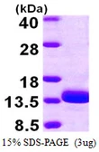Human TSTD1 protein, His tag. GTX57504-pro