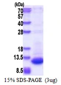Human DPH3P1 protein, His tag. GTX57505-pro