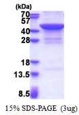 Human JMJD7 protein, His tag. GTX57507-pro