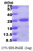Human AK6 protein, His tag. GTX57511-pro