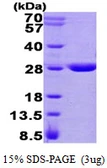 Human GSTZ1 protein, His tag. GTX57515-pro